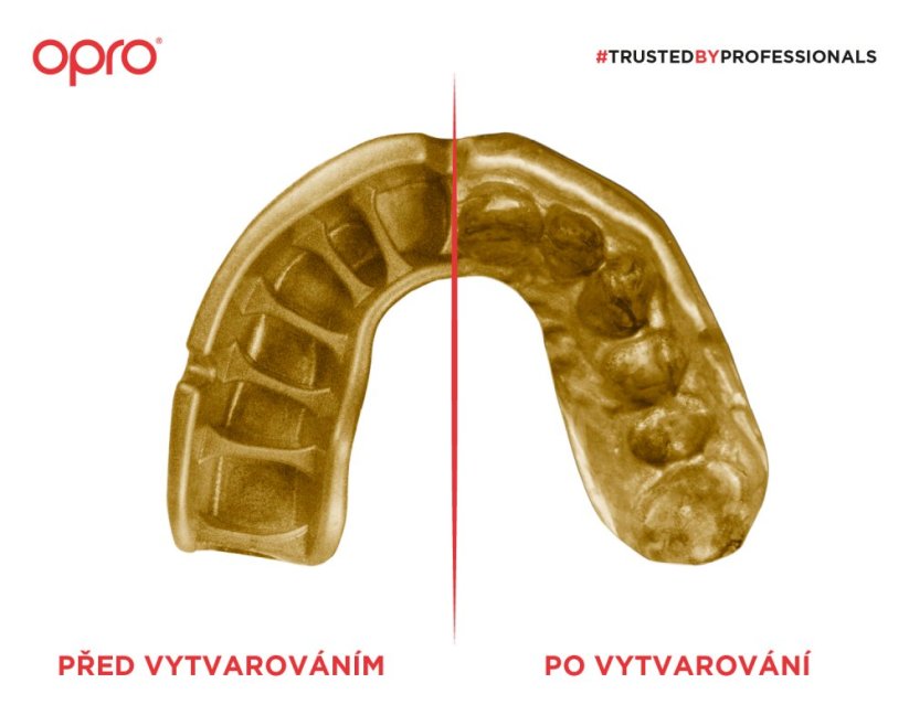 Chránič na zuby OPRO Gold UFC